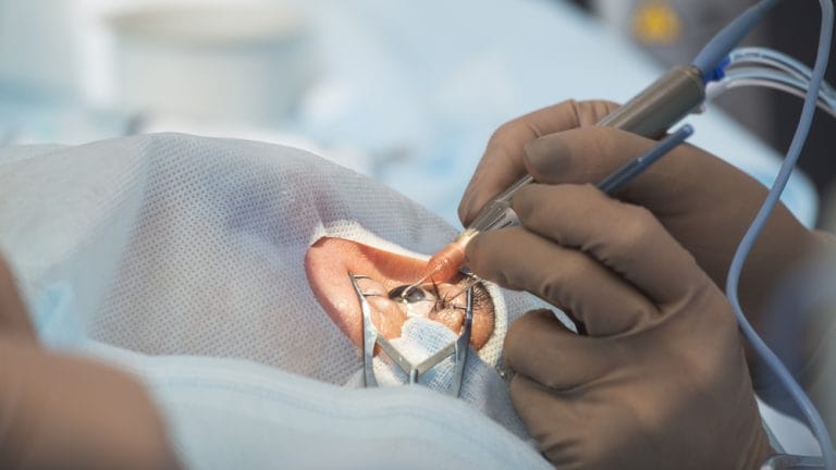 Retina Surgery – Iclinix- Advanced Eye Care