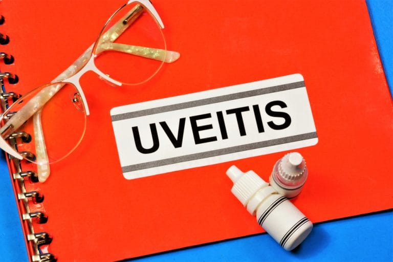 BEST PLACE FOR UVEITIS TREATMENT IN DELHI NCR