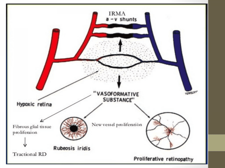 Best cataract surgery in South Delhi
