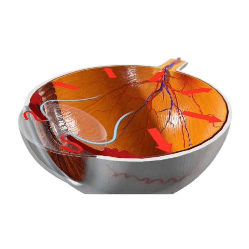 Best Diabetic Eye Care in Delhi