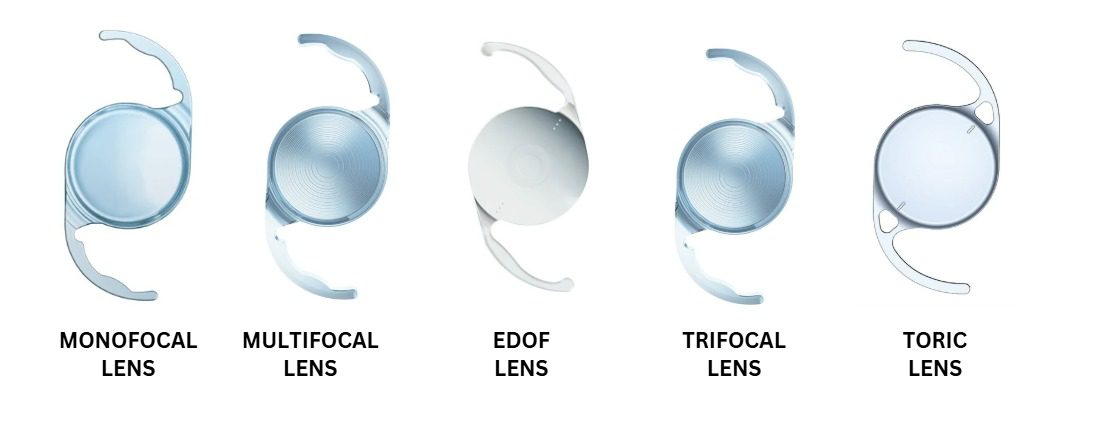 Best Ophthalmologist in South Delhi