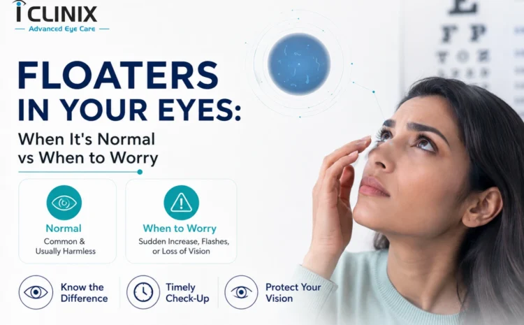 Floaters in Your Eyes: When It’s Normal and When to Worry