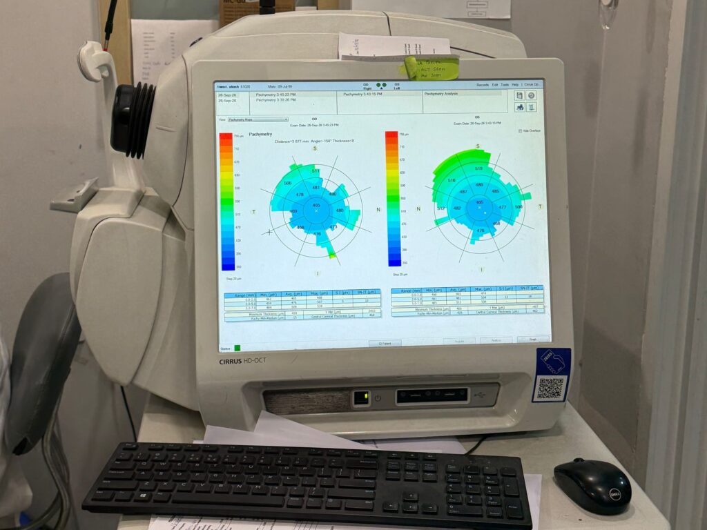 Zeiss Cirrus OCT scanner showing nerve fibre layer maps