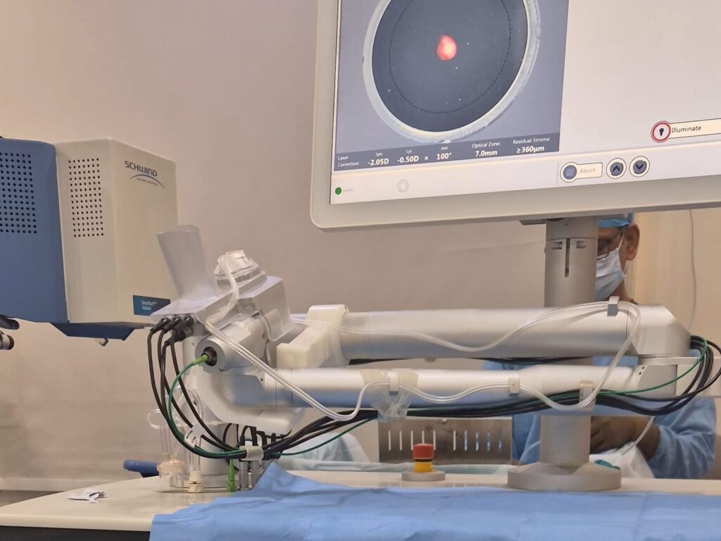 Femtosecond laser in the IClinix LASIK suite