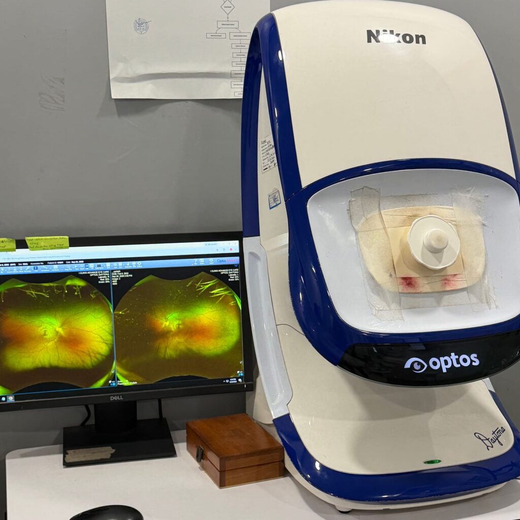 Optos ultra-widefield retinal camera with retina scans on screen